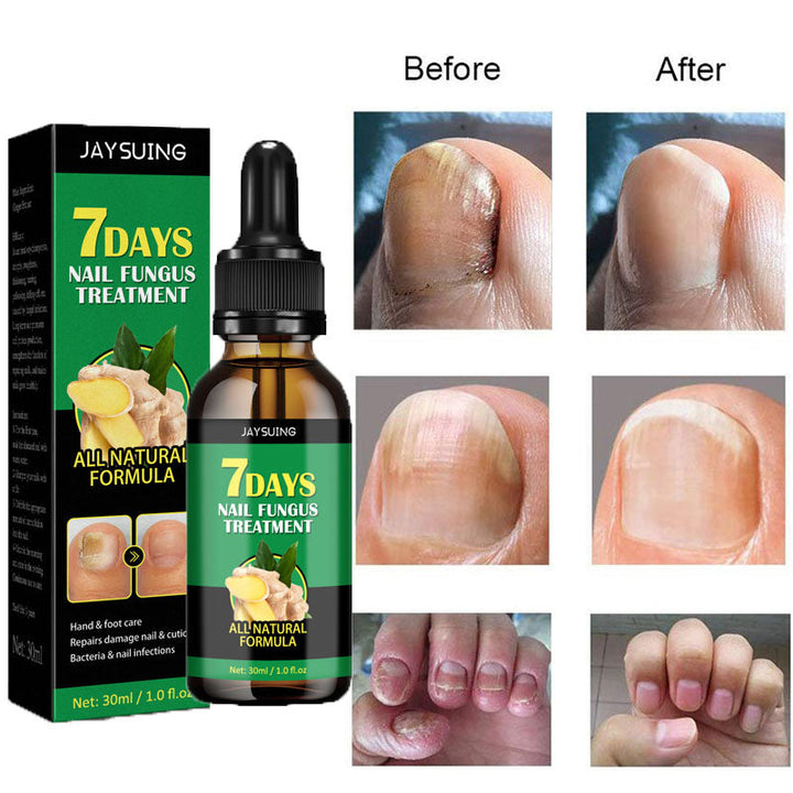 Antifungal nail serum