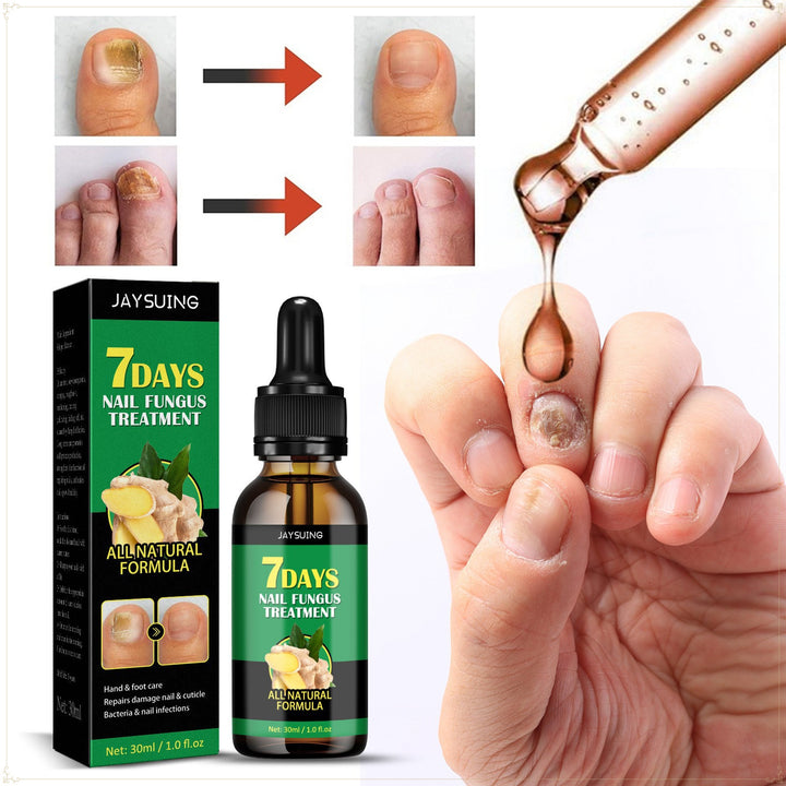 Antifungal nail serum